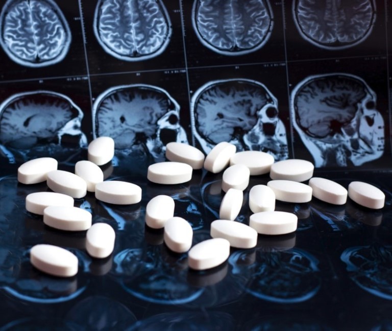 Innovación en alzhéimer con donanemab