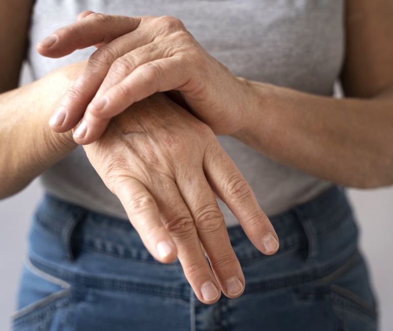 Abordaje de la artritis reumatoide en América Latina