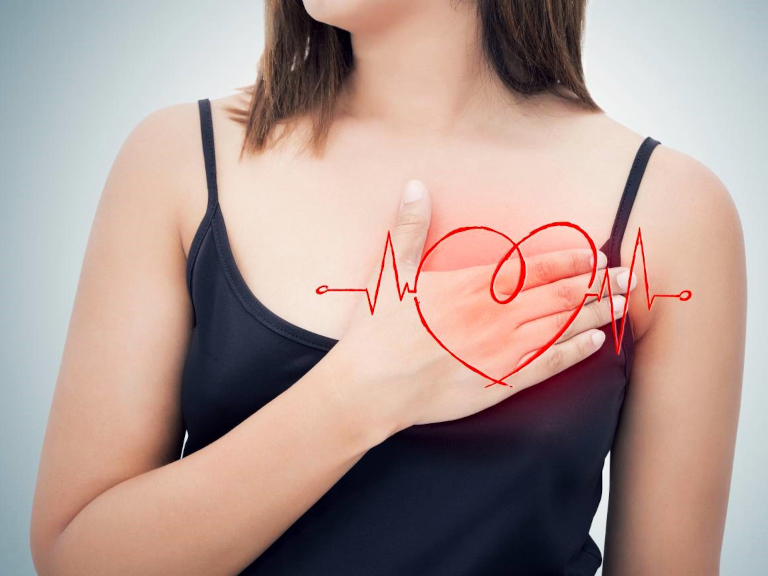 clinica mayo, infarto, infartos, ataque cardiaco