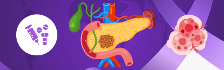 Triple amenaza terapéutica conduce a la remisión del cáncer de páncreas