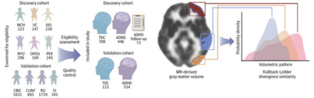 El cerebro revela tres biotipos del TDAH en niños