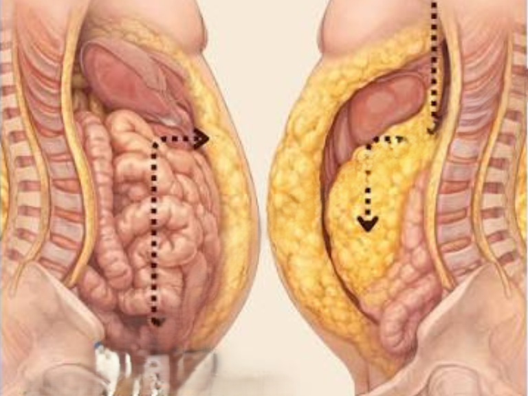 El tic-tac de la grasa abdominal