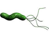 Erradicar el <em>H. pylori</em> previene recurrencia de carcinomas gástricos