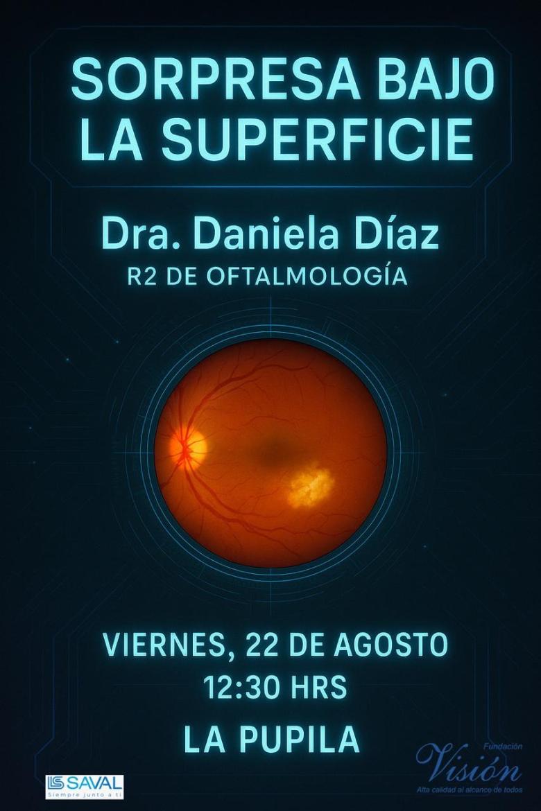 Sorpresa bajo la superficie