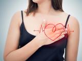 clinica mayo, infarto, infartos, ataque cardiaco