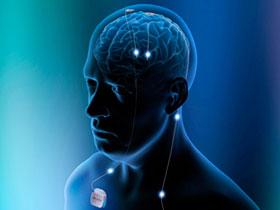 Estimulación cerebral profunda atenúa la anorexia nerviosa