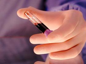 Nitritos y nitratos son protectores contra la leptospirosis severa