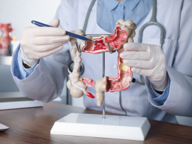 Nuevas perspectivas en el manejo de la diverticulitis