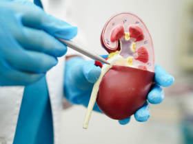 enfermedad renal crónica, inhibidores del cotransportador sodio-glucosa tipo 2, inhibidores SGLT2, canagliflozina, dapagliflozina, empagliflozina, lesión renal aguda