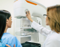 mamografía, cribado mamográfico, cáncer de mama, detección de cáncer de mama