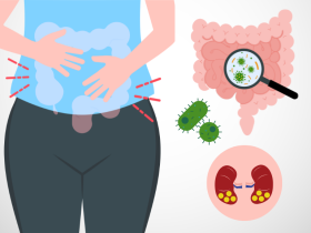 bacterias, cálculos renales, genética 